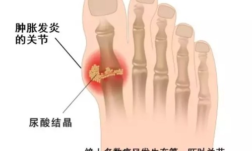 精神病人全麻用药要点多久-权威精神病人麻醉平台,分享专业精神病人全麻什么药不能用知识_精神病人全麻用药要点网